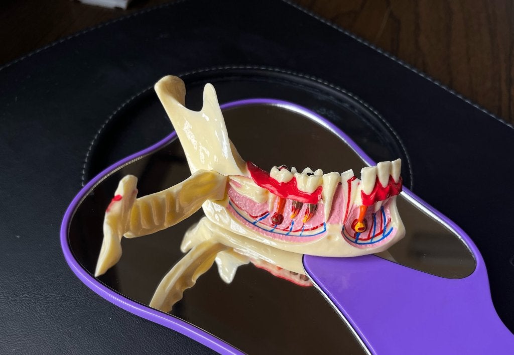Tandheelkundig Endodontisch Anatomie Model / Tandarts Kies, Diversen, Verzenden, Nieuw