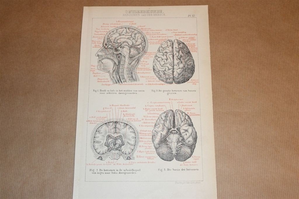Antieke anatomische prent - Hersenen van de mens - 1875 !!, Verzamelen, Foto's en Prenten, Ophalen of Verzenden, Voor 1940, Zo goed als nieuw