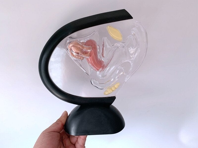 Baarmoeder Menselijk Anatomie Model / School Medisch, Diversen, Schoolbenodigdheden, Nieuw, Verzenden
