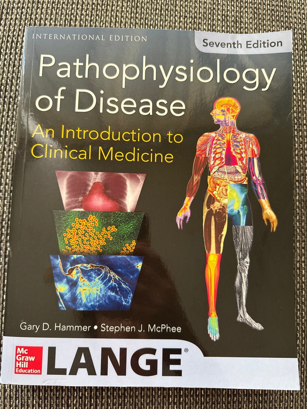 Pathophysiology of Disease - International Edition, Ophalen of Verzenden, Beta, Zo goed als nieuw, WO