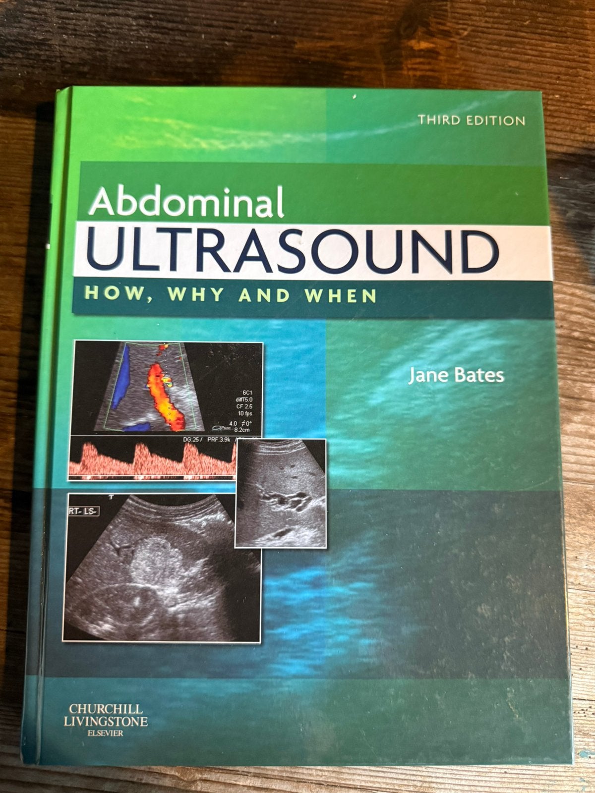 Studieboek abdominal ultrasound, Boeken, Ophalen of Verzenden, Beta, Zo goed als nieuw, Niet van toepassing