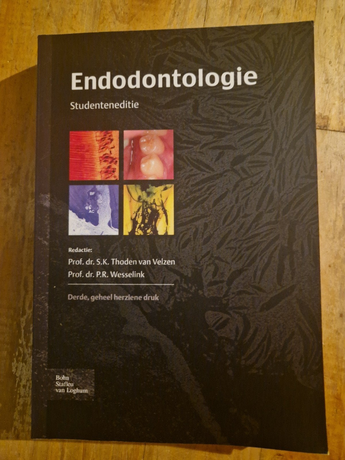 Endodontologie - Studieboek Tandheelkunde, Boeken, Ophalen of Verzenden, WO, Zo goed als nieuw, Prof. dr. S.K. Thoden van Velzen, Prof. dr. P.R. Wesselink