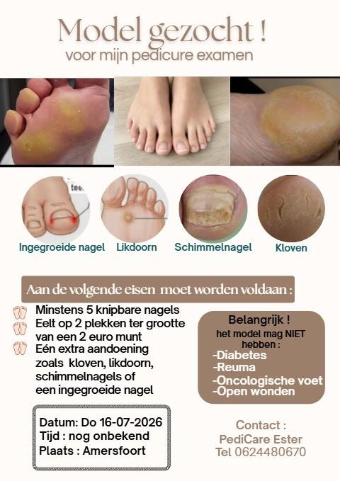 Model voor beginnend Pedicure gezocht?, Ophalen of Verzenden, Overige typen