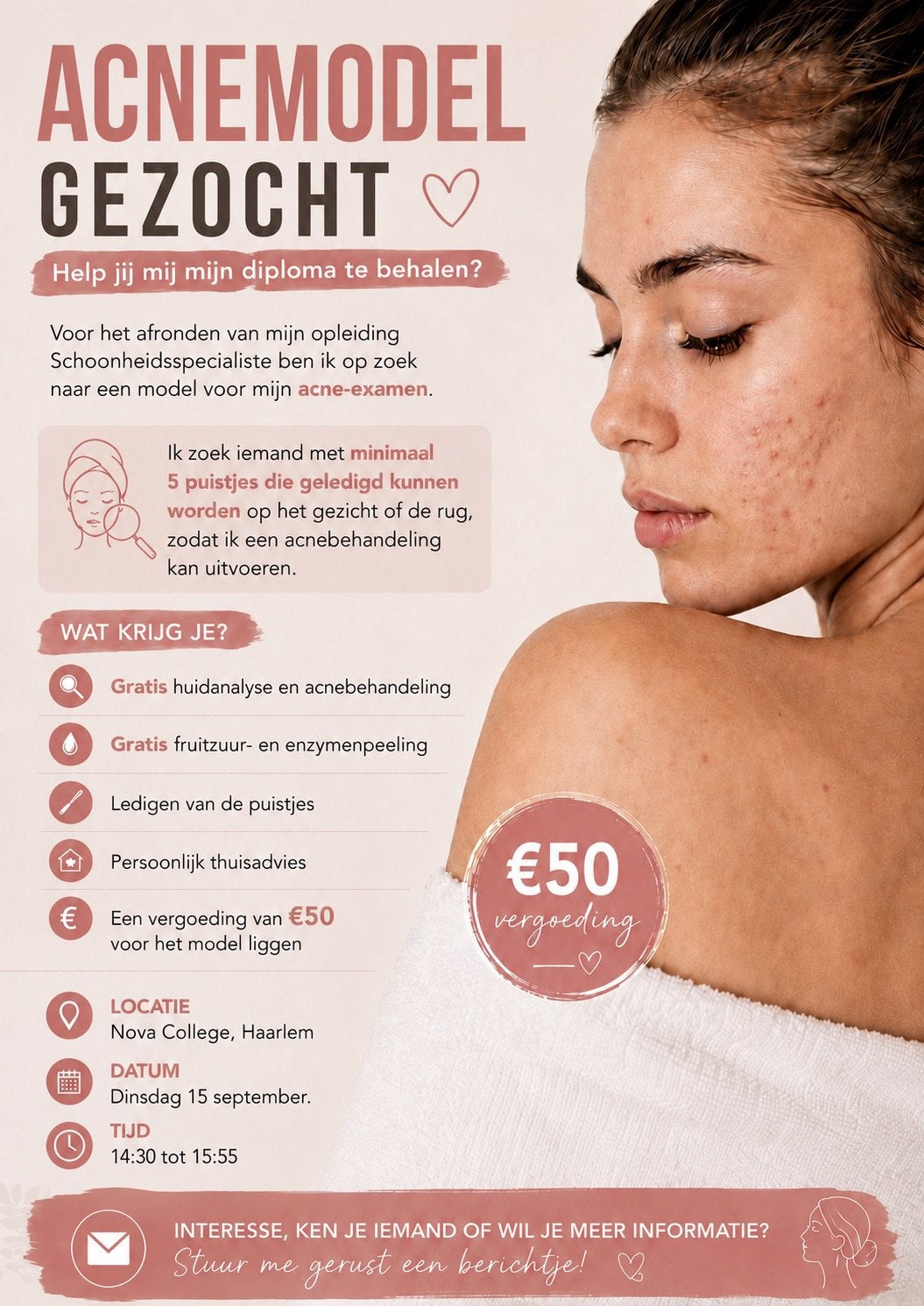Acnemodel gezocht voor een acne behandeling met spoed!, Ophalen, Nieuw, Gehele gezicht, Reiniging