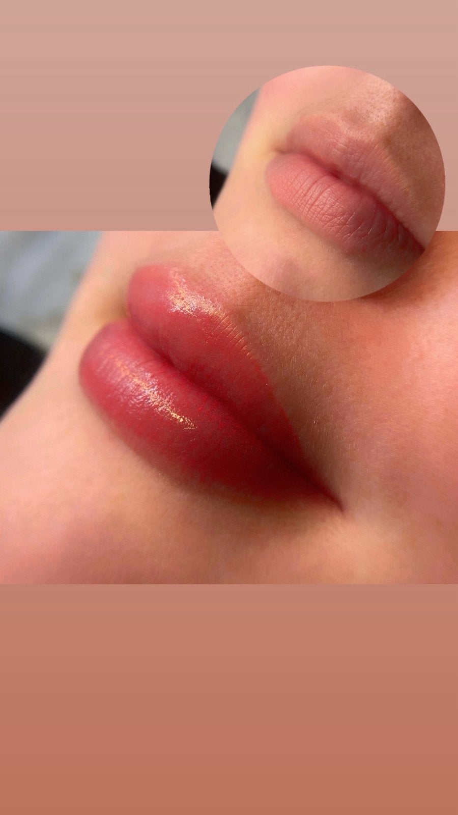 Lipblush pmu, Ophalen, Overige typen