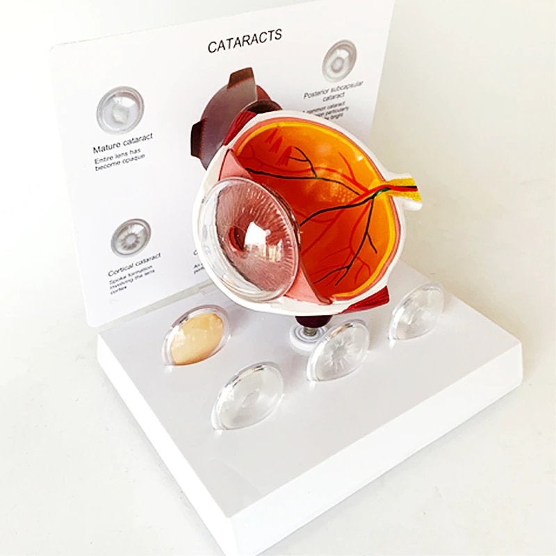 Menselijk Oog Anatomie Model / School Opticien Medisch Mens, Verzenden, Nieuw