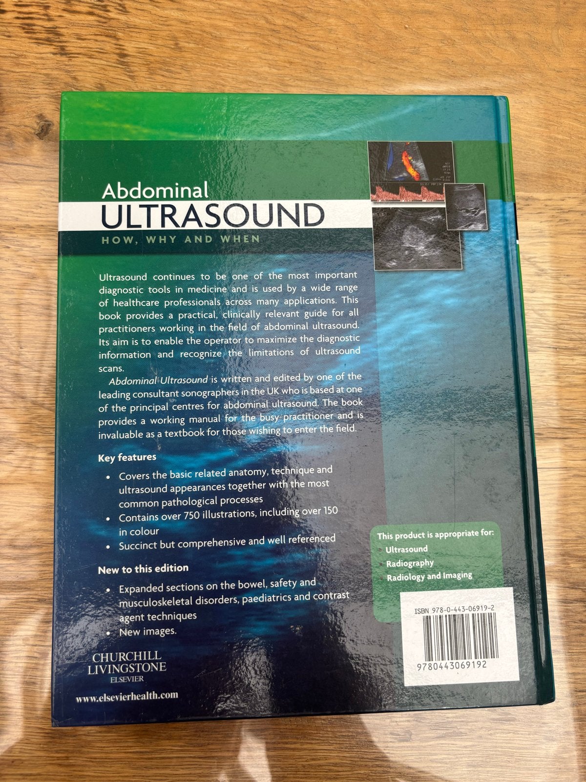 Abdominal Ultrasound: How, Why and When - Jane Bates (MBRT), Boeken, Ophalen of Verzenden, Beta, Zo goed als nieuw, HBO