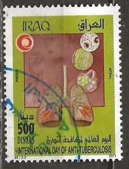Irak 10, longen voor asmae