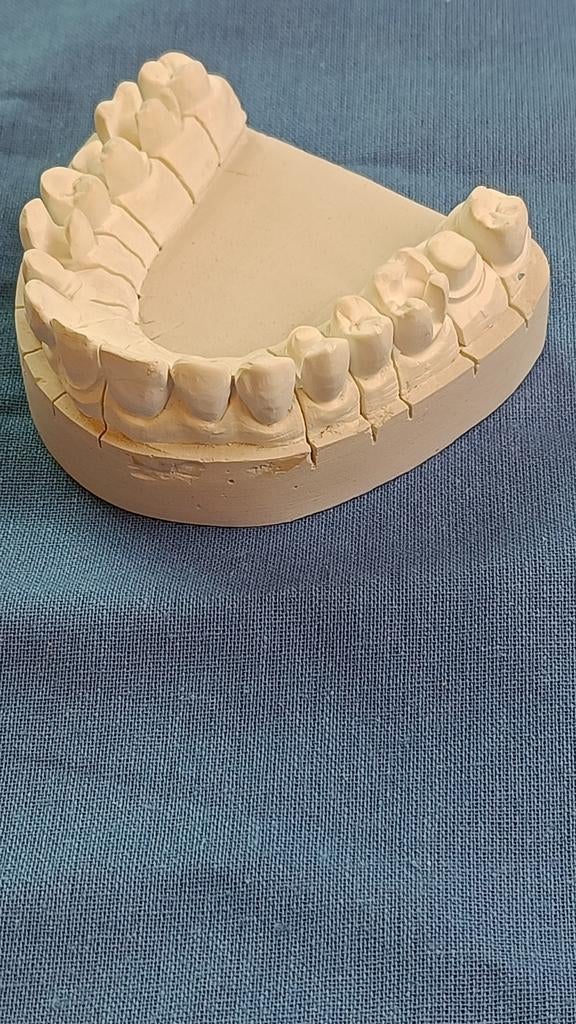 Tandarts preparatie voorbeelden op gipsmodel., Diversen, Braces, Ophalen of Verzenden