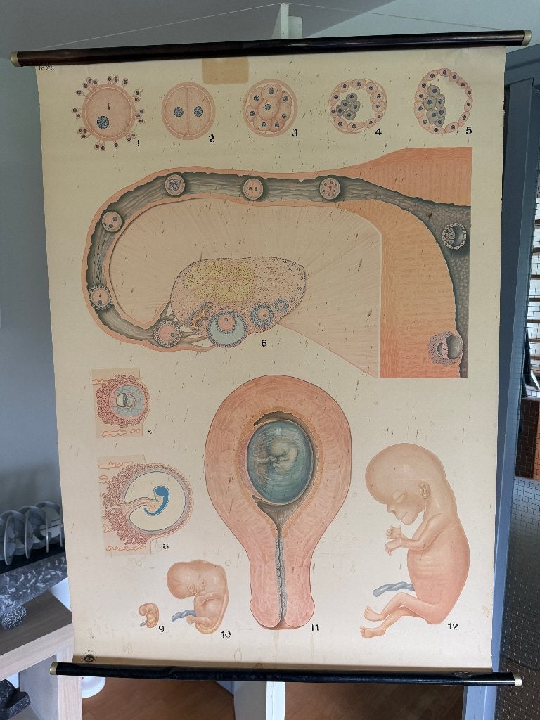 antieke schoolplaat Embrylogie op canvas, Ophalen of Verzenden, Natuur en Biologie