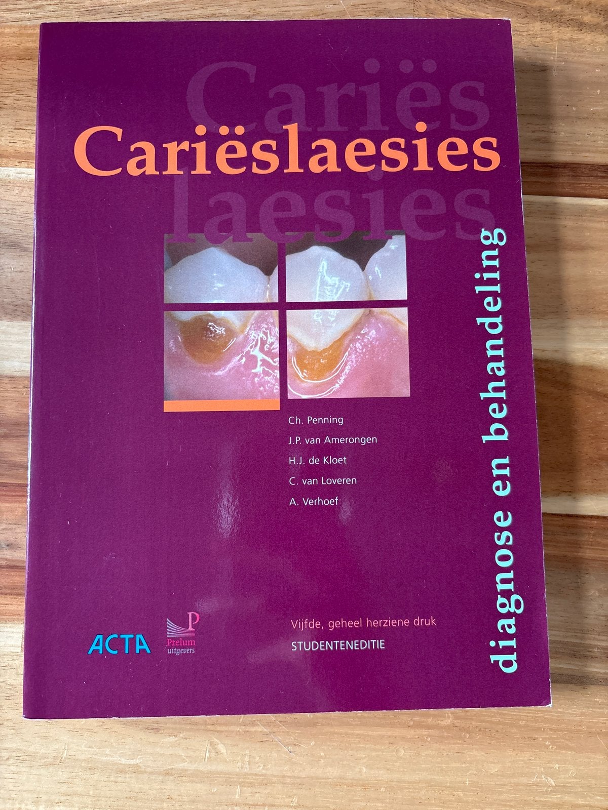 Cariëslaesies: diagnose en behandeling - Studenten editie, Ophalen of Verzenden, Beta, Zo goed als nieuw, HBO