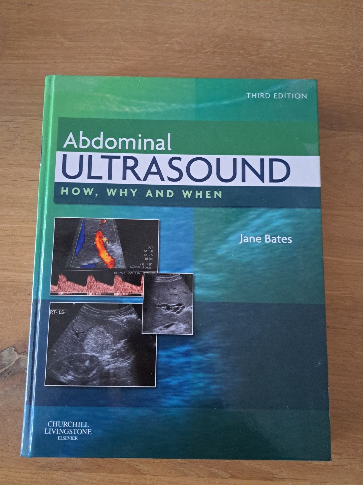 Abdominal Ultrasound: How, Why and When - Jane Bates, Jane Bates, Zo goed als nieuw, Beta, HBO