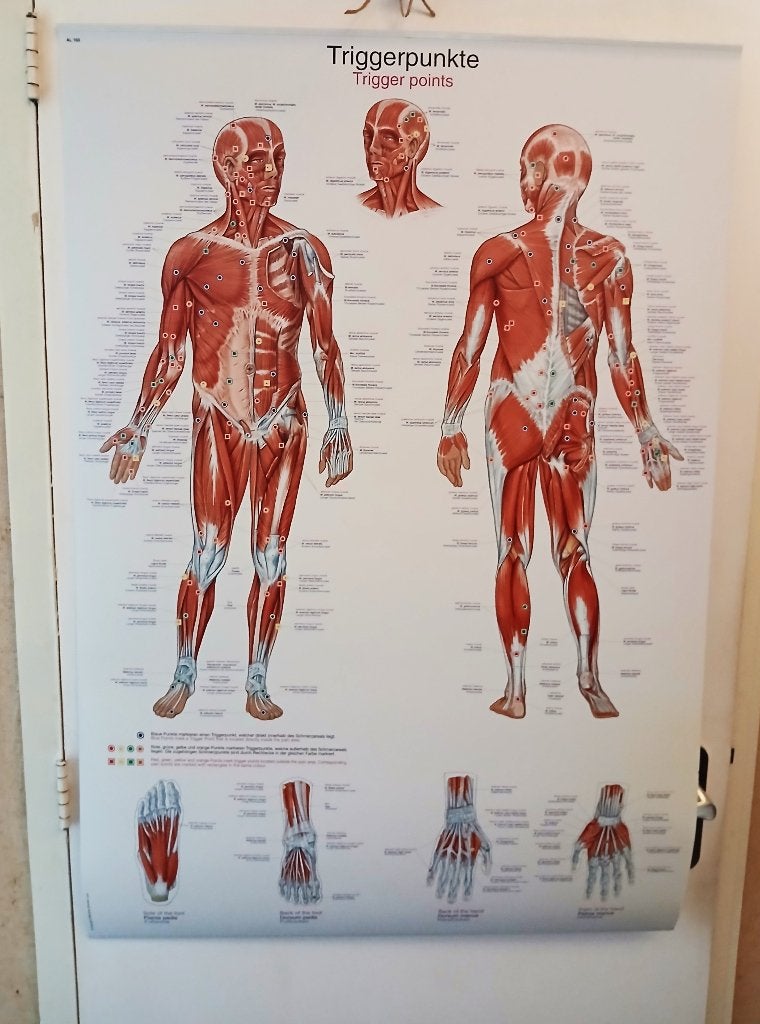Anatomische poster trigger points triggerpunkte 70 x 100 cm, Antiek en Kunst, Curiosa en Brocante, Ophalen