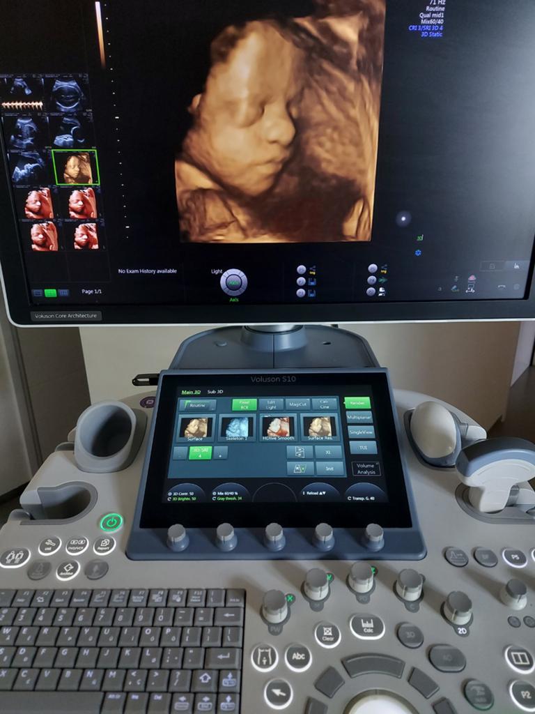GE Voluson S10 Echoapparaat 3D/4D, met vaginale probe, Ophalen