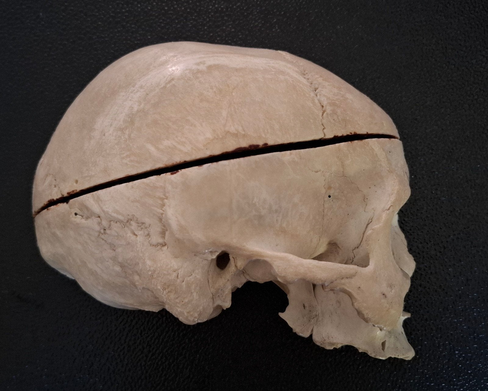 Opengewerkte halve schedel mens anatomisch model taxidermie, Ophalen of Verzenden, Gebruikt