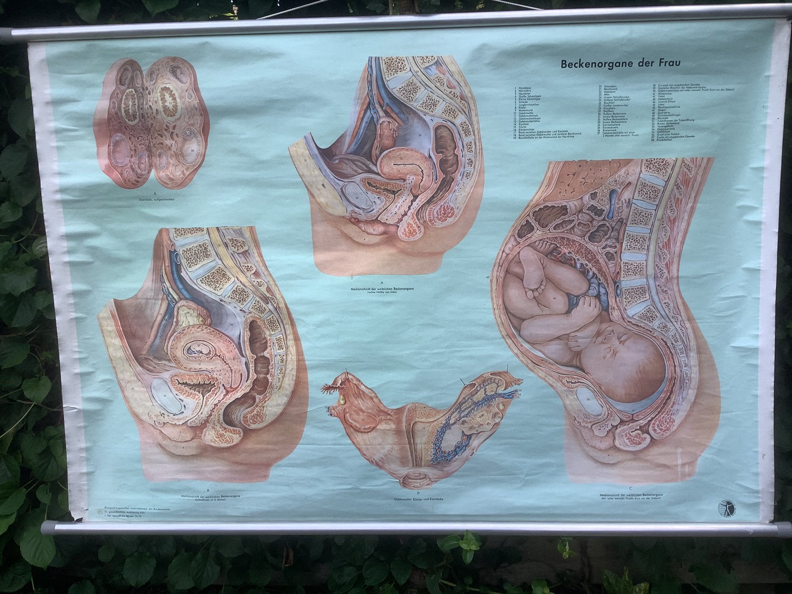 Schoolplaat vintage medisch voortplanting orgaan vrouw, Ophalen of Verzenden, Natuur en Biologie