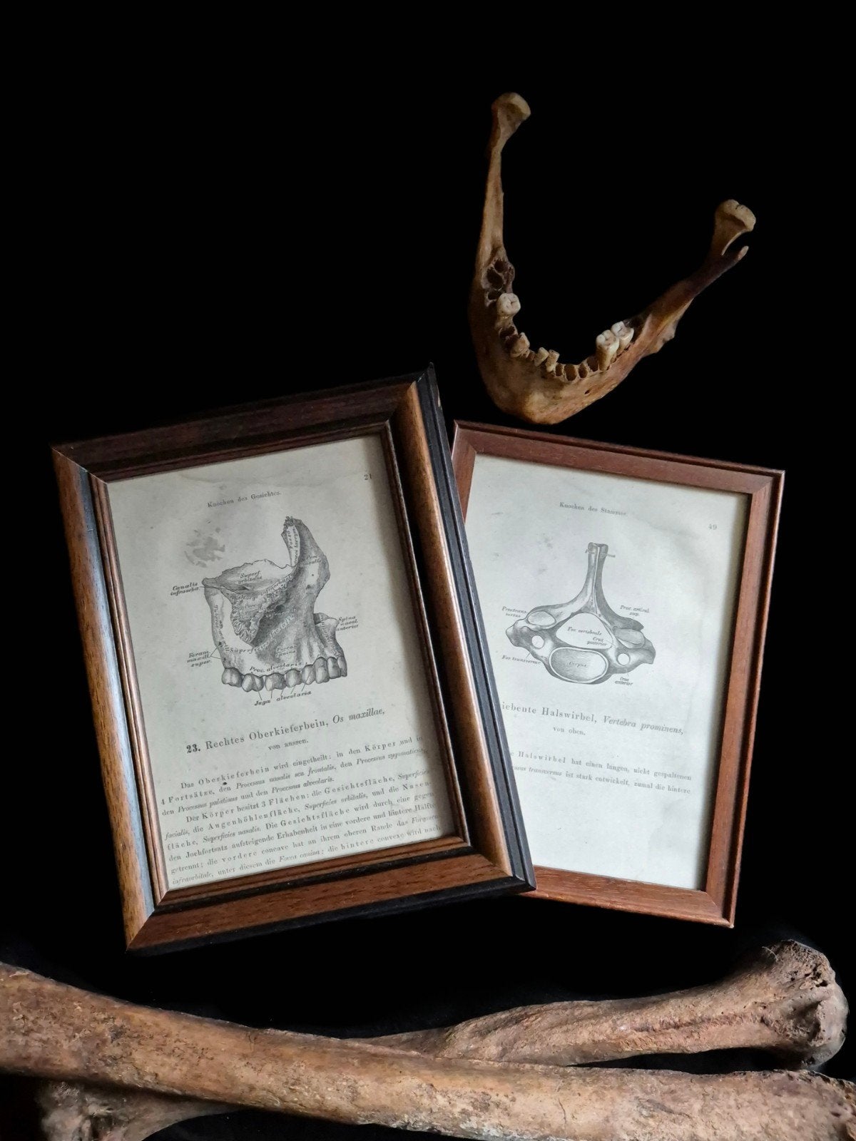 Antieke anatomie prenten, Antiek en Kunst, Curiosa en Brocante, Ophalen of Verzenden