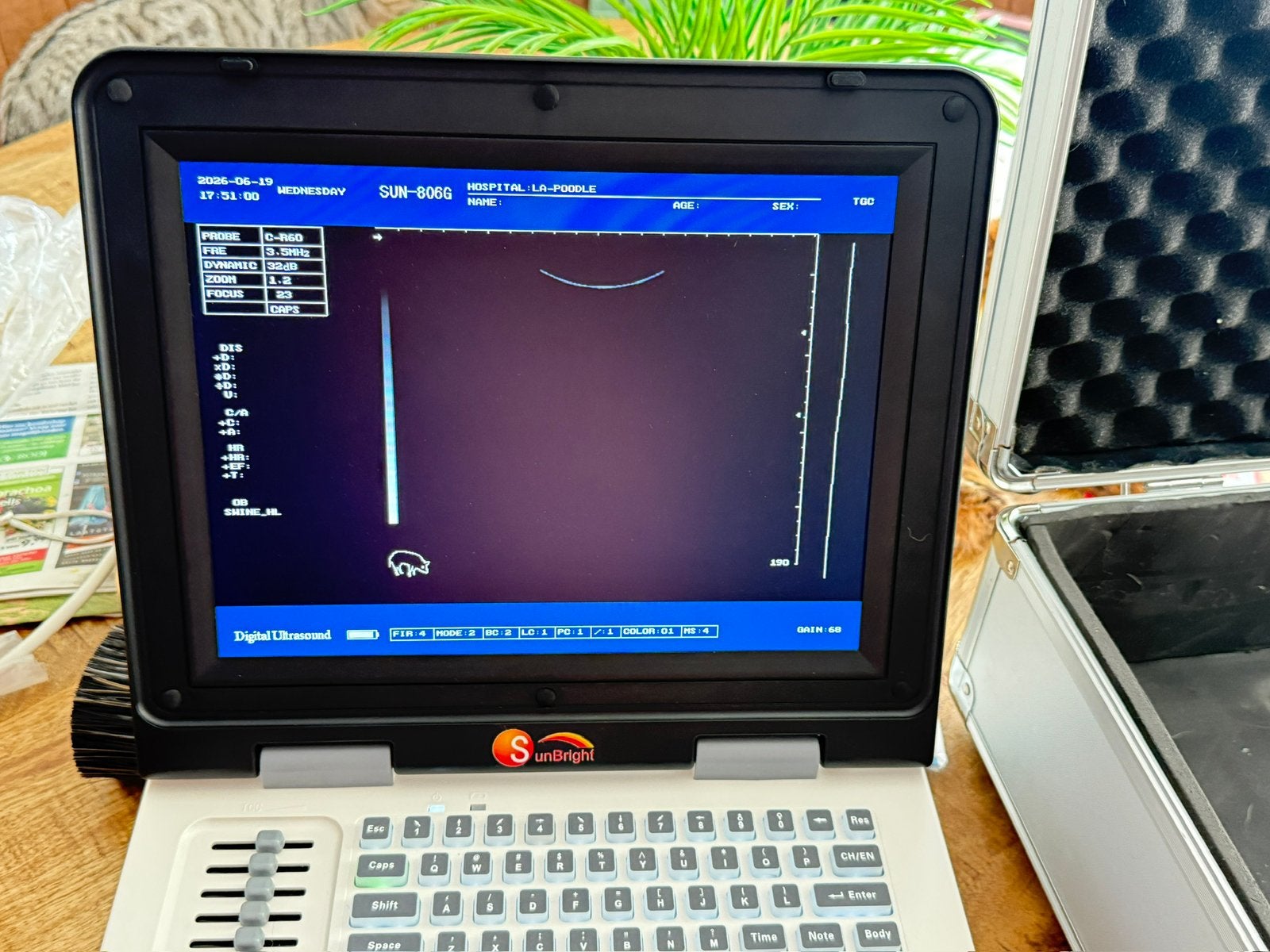 Echo apparaat SunBright Ultrasound Diagnostisch  in Koffer, Ophalen of Verzenden