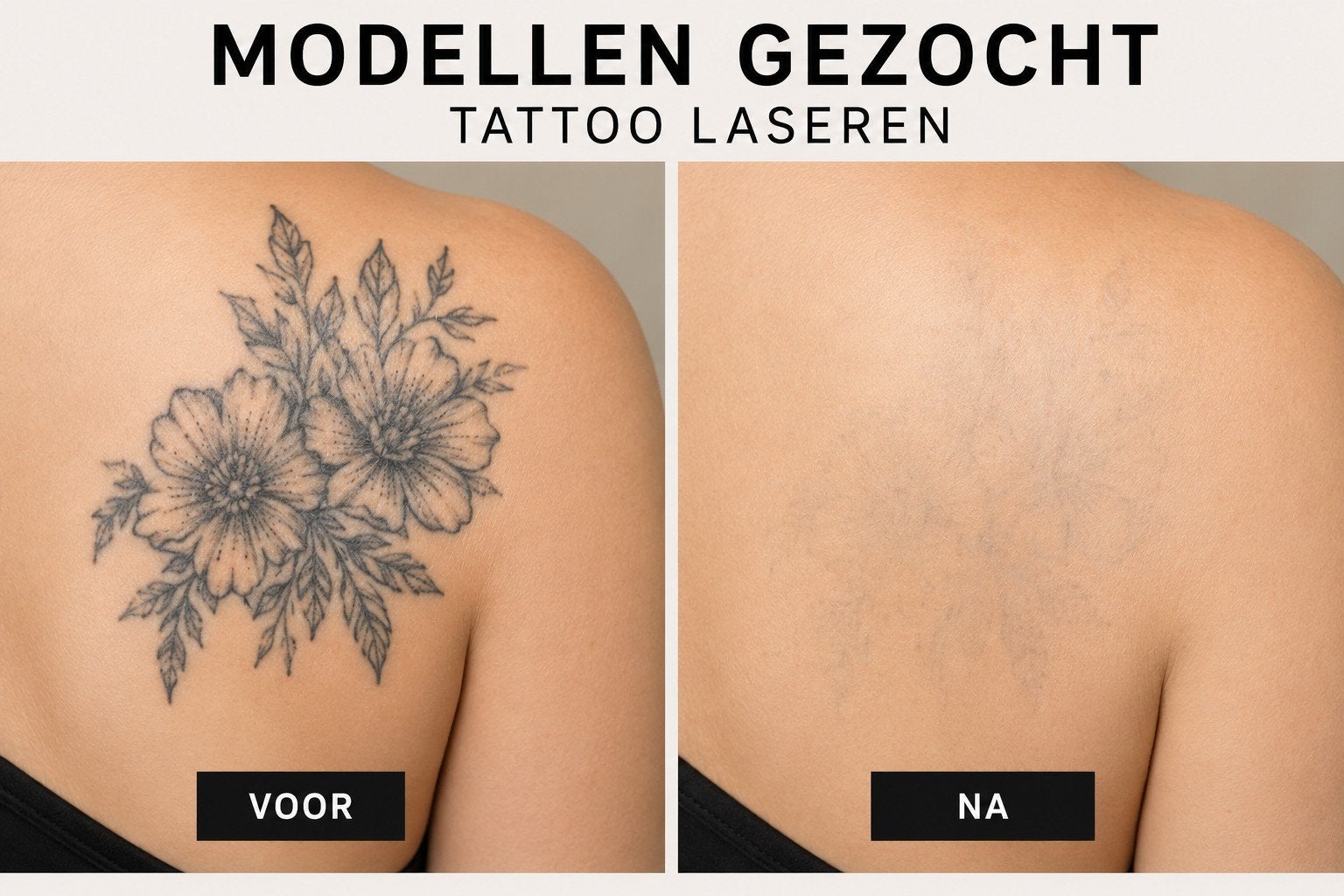 Modellen gezocht gratis tattoo of permanente make-up laseren, Eén persoon, Kortingsbon