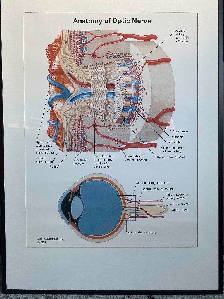De anatomie van het oog en oogzenuw. Twee posters, Verzamelen, Posters, Zo goed als nieuw, Overige onderwerpen, A1 t/m A3, Rechthoekig Staand