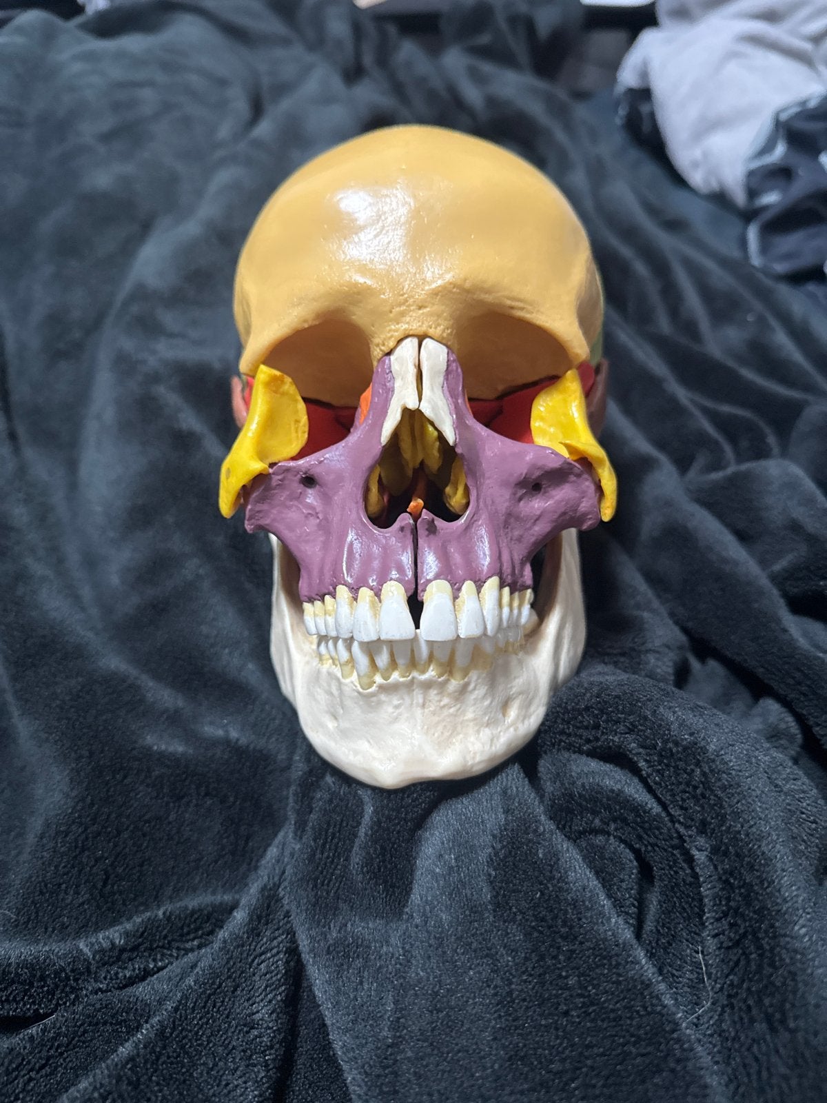Somso Anatomisch Schedelmodel - Hoogwaardige Kwaliteit, Ophalen of Verzenden, Zo goed als nieuw