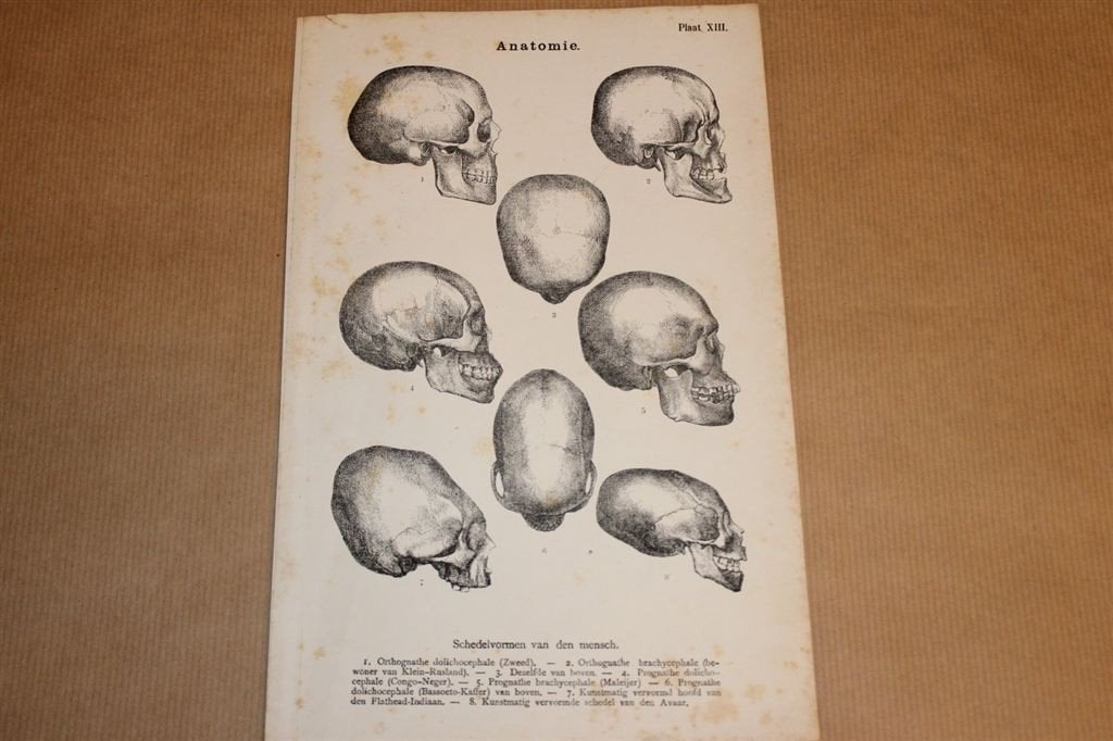 Antieke anatomische prent - Schedelvormen v/d mens - 1875, Verzamelen, Foto's en Prenten, Ophalen of Verzenden, Voor 1940, Zo goed als nieuw