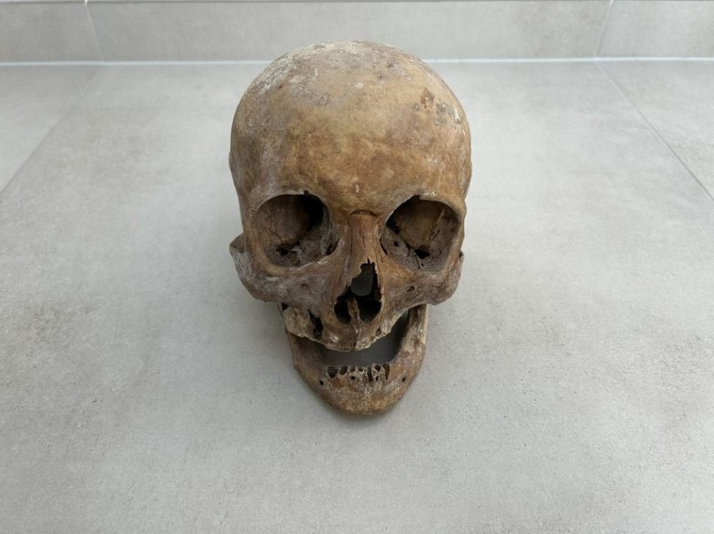 Anatomie osteologie - Schedel mens - echt, Ophalen of Verzenden