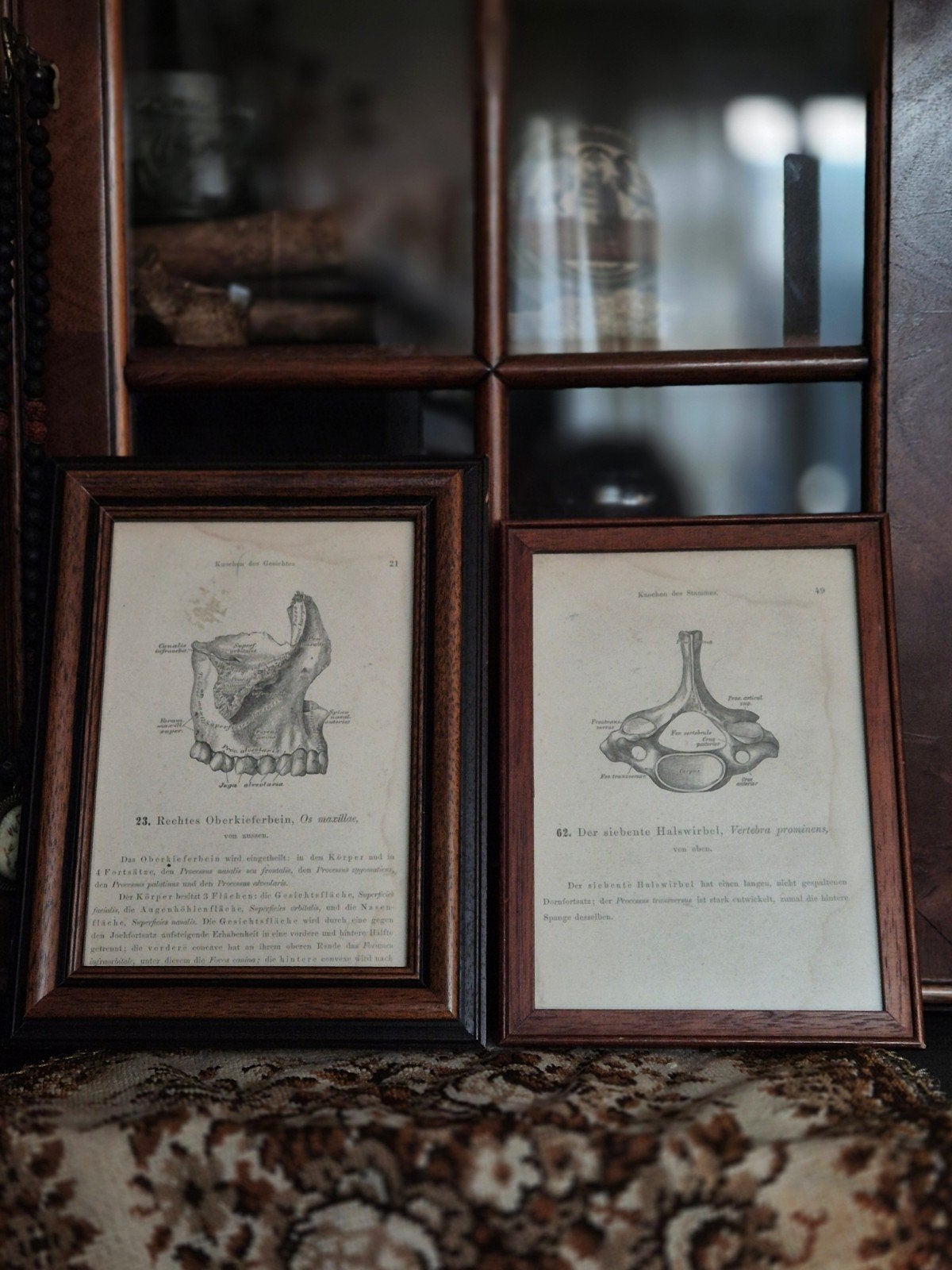 Antieke anatomische prenten, Ophalen of Verzenden, Voor 1940, Zo goed als nieuw, Prent