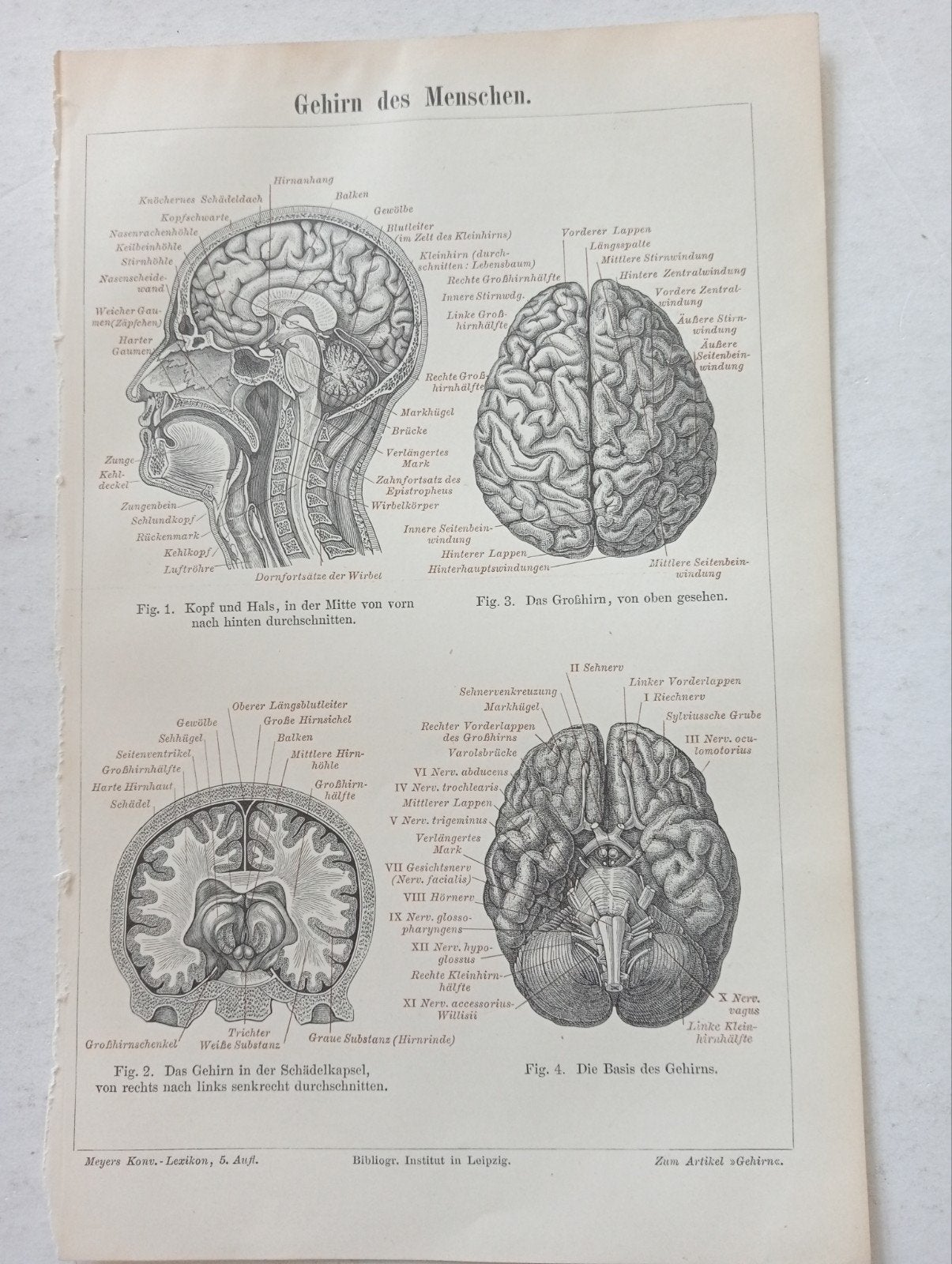 Anatomische Medische Gravure Gehoor & Hersenen 1895, Ophalen of Verzenden