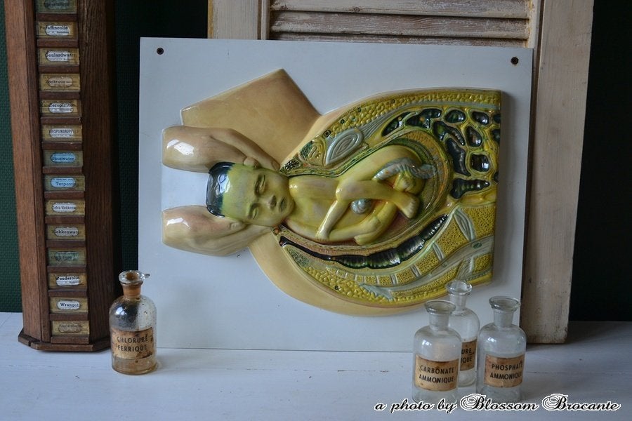 Anatomische plaat “De Bevalling” BLOSSOM BROCANTE, Antiek en Kunst, Ophalen of Verzenden