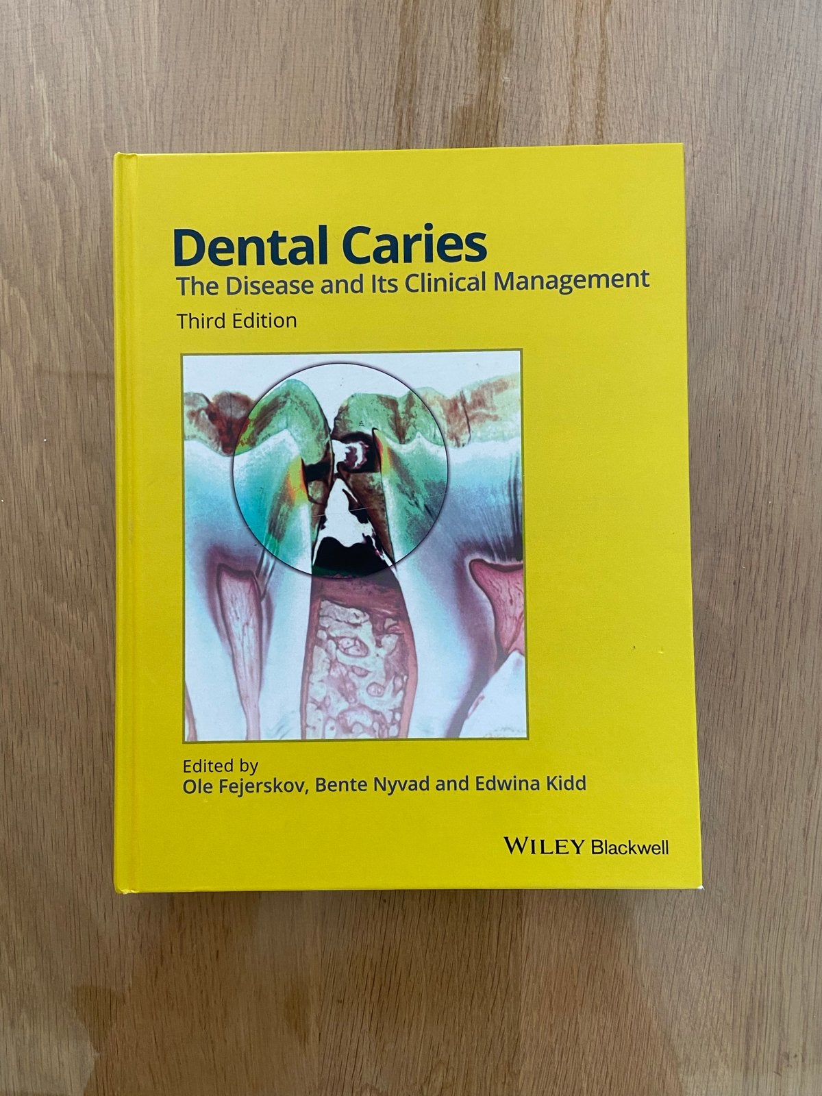 Studieboek Dental Caries: Mondzorgkunde HBO/WO, Boeken, Ophalen of Verzenden, Beta, Gelezen, HBO