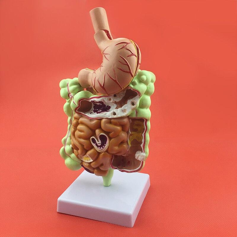 Spijsvertering Menselijk Anatomie Model School Medisch Darm, Verzenden, Nieuw