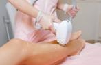Laserontharing: Gladde huid, langdurig resultaat|20% korting, Huidbehandeling