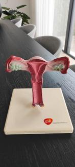 Anatomisch Model Baarmoeder, Ophalen
