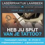 Spijt van je Tattoo ? , wij kunnen je helpen !