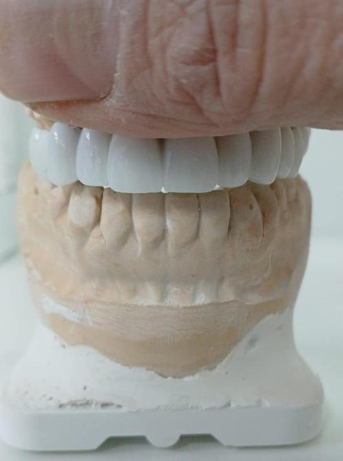 Tandtechniek Tandarts, Diversen, Braces, Nieuw, Ophalen of Verzenden