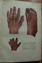 Homeopathie - Homoeopathie in de praktijk J. Voorhoeve 1948, Gelezen, Dieet en Voeding, Ophalen of Verzenden, J. Voorhoeve