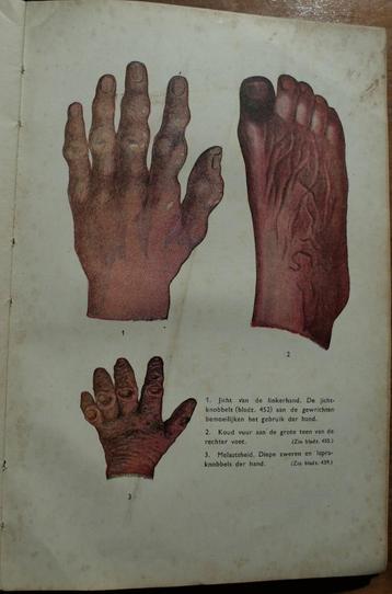 Homeopathie - Homoeopathie in de praktijk J. Voorhoeve 1948 beschikbaar voor biedingen