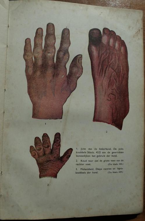 Homeopathie - Homoeopathie in de praktijk J. Voorhoeve 1948, Boeken, Gezondheid, Dieet en Voeding, Gelezen, Dieet en Voeding, Ophalen of Verzenden