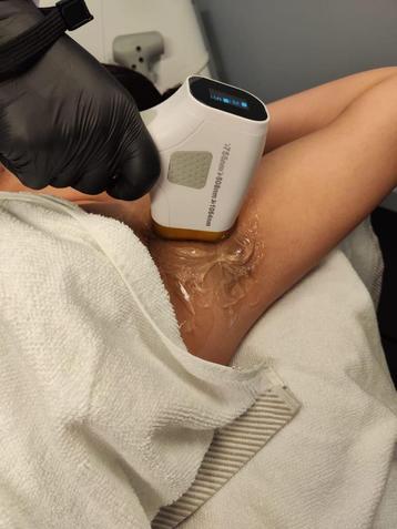 Laser ontharen voor mannen & vrouwen – Snel resultaat beschikbaar voor biedingen