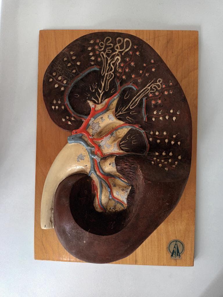 Antiek Medisch Anatomisch model Nier Sonneberg lesmateriaal, Antiek en Kunst, Ophalen of Verzenden