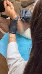 Gezocht pedicure modellen