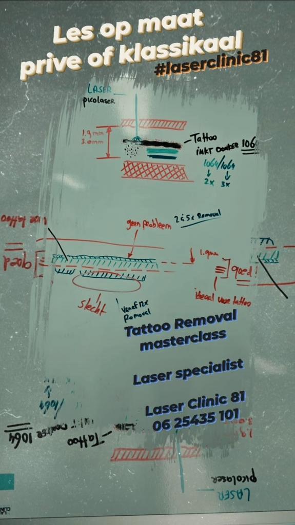 Workshop Tattoo Removal Picolaser nu vanaf €265 inclusief., Vacatures, Vacatures | Modellen, Starter, Overige vormen, Overige uren