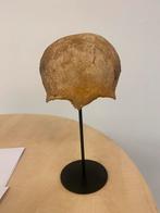 Mensen schedel- antiek- medisch- educatieve doeleinden, Ophalen of Verzenden