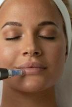 Huidverzorging met Dermapen, Ophalen, Gehele gezicht, Verzorging