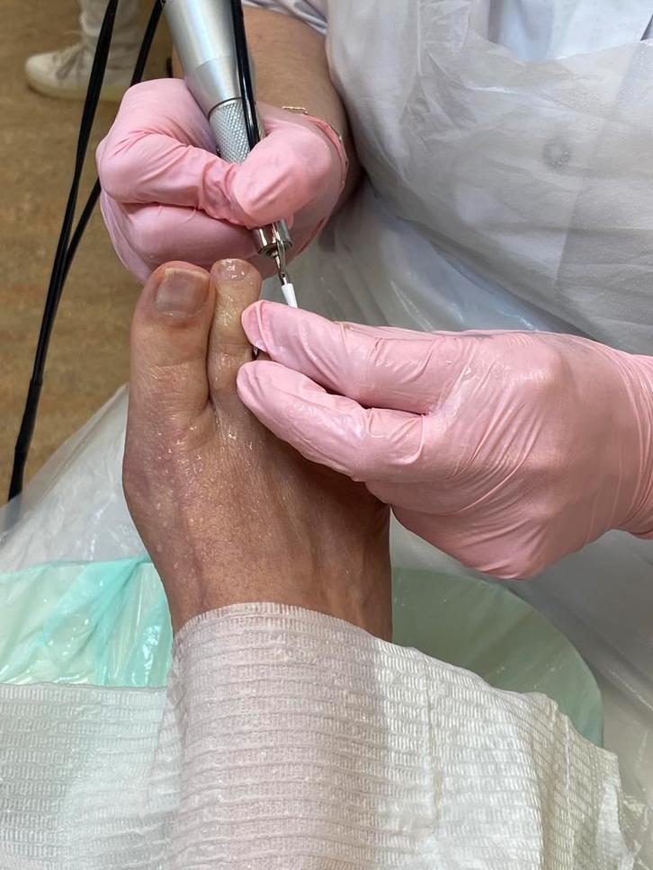 Model pedicure/ voetverzorging gezocht., Vacatures, Vacatures | Modellen, Overige niveaus, Starter, Overige vormen, 33 - 40 uur