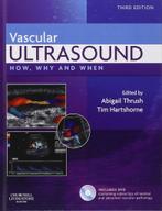 vascular Ultrasound (MBRT master echografie), Boeken, Studieboeken en Cursussen, Ophalen, Beta, Zo goed als nieuw, HBO