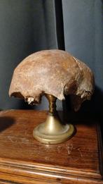 Bodemvondst - mensen schedel - rariteiten - middeleeuws, Verzamelen, Overige Verzamelen, Ophalen of Verzenden, Gebruikt