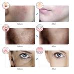 Huidverzorging - Facial Led Masker 7 Kleuren, Niet ingevuld, Niet ingevuld, Nieuw, Ophalen of Verzenden