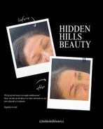 Wenkbrauw behandelingen, Ophalen, Nieuw, Ogen, Verzorging